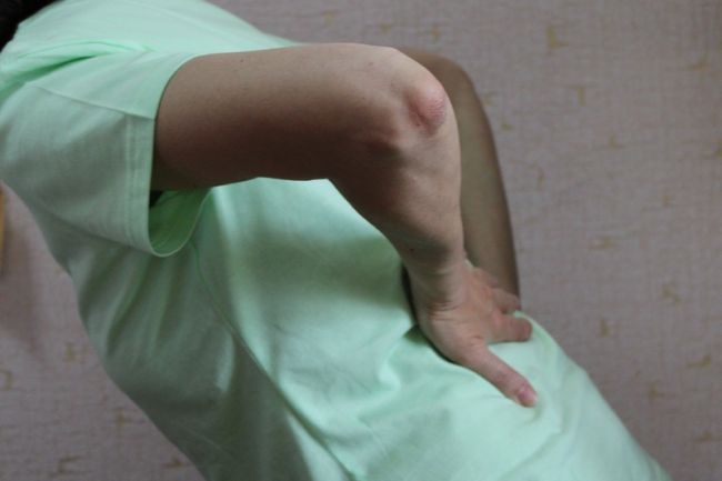 Новомосковцы могут из первых уст узнать, как сохранить здоровье спины