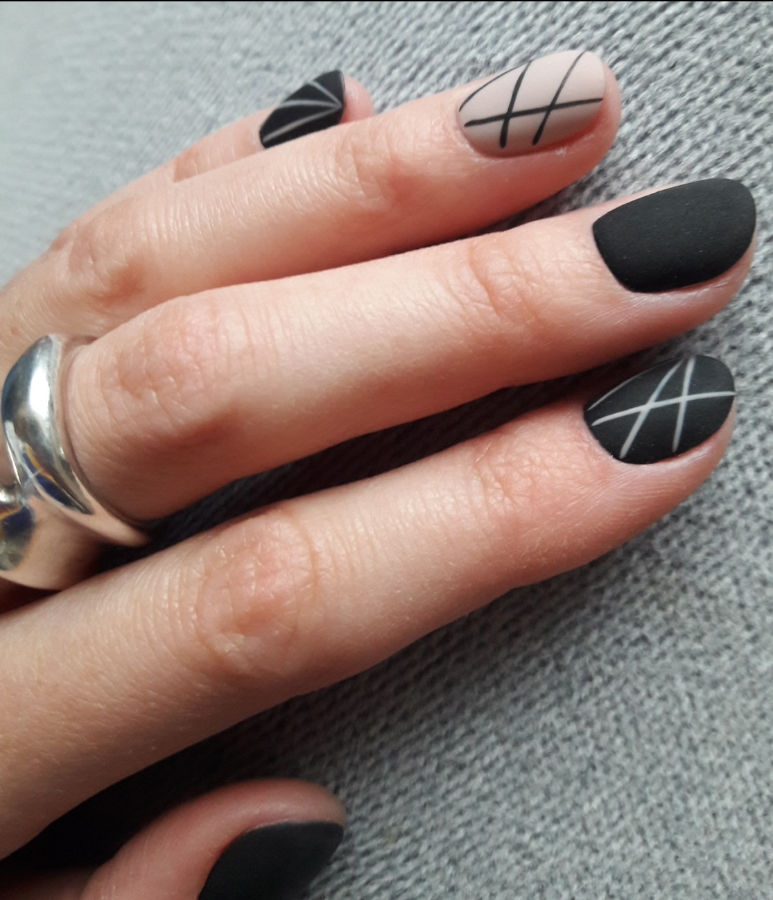 Как позаботиться о здоровье кожи зимой? Как позаботиться о здоровье кожи зимой?